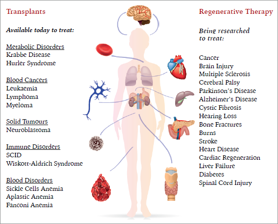 Stem Cell Therapy Offers New Hope for Treating Fistulas Stem Cell Therapy Offers New Hope for Treating Fistulas new photo Stem Cell Therapy Offers New Hope for Treating Fistulas Stem Cell Therapy Offers New Hope for Treating Fistulas new photo