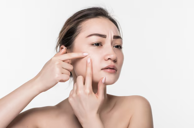 Tips On Getting Rid Of Pimples Image