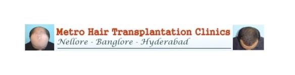 Metro Hairtransplant - Sunday Market - Nellore