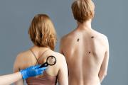 Knowing About Xeroderma Pigmentosum Disease