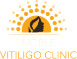 Noble Vitiligo Clinic - Bangalore